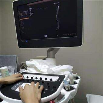 PHILIPS上门修理飞利浦彩超机探头没有超声界面显示故障维修