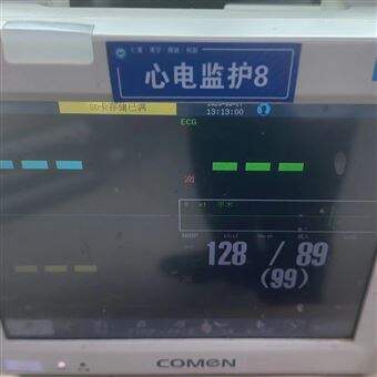 PHILIPS修理电话飞利浦心电监护仪开机屏幕黑屏不亮故障维修