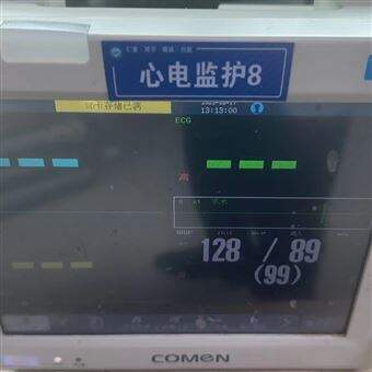 PHILIPS一天修好飞利浦心电监护仪开机显示屏黑屏不亮维修